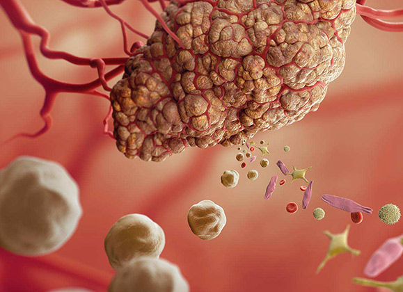 Cancer Cell Culture Media
