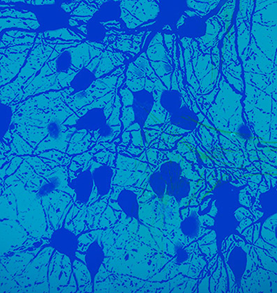 Neural Cell Culture Media
